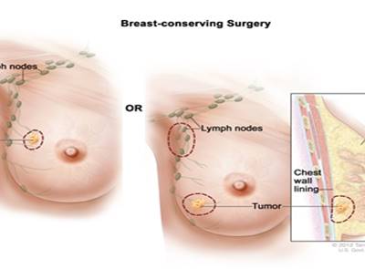 lymph node